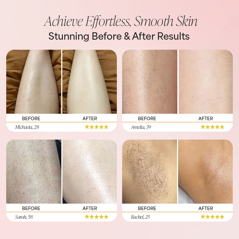 Avaleric® Electric Trimmer 2.0