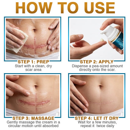 Avaleric® 100% Silicone Scar Cream Formula