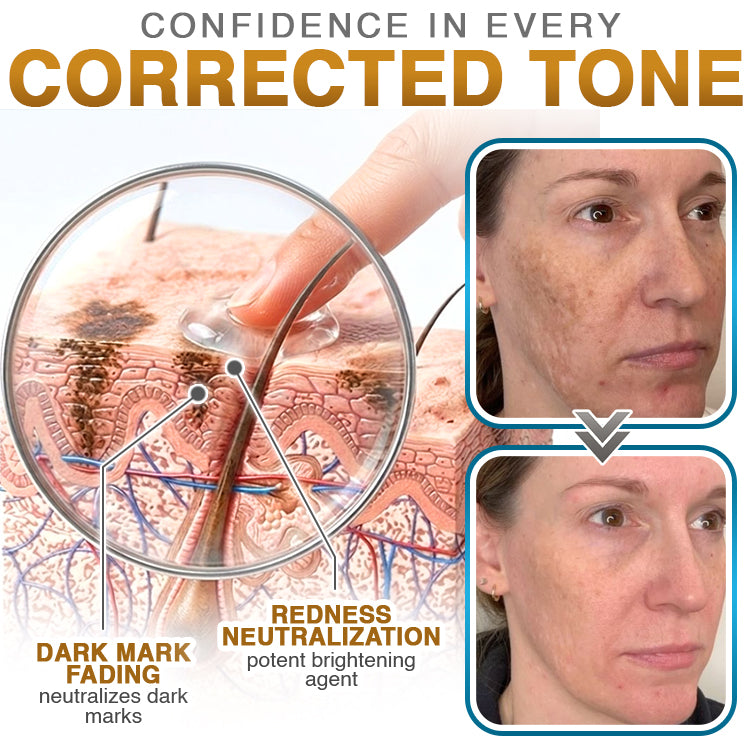 Avaleric® 100% Silicone Scar Cream Formula
