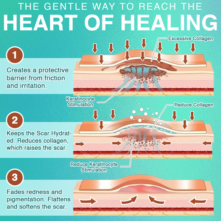 𝘾𝙖𝙧𝙚𝘽𝙧𝙚𝙚𝙯𝙚® Microneedle Scar Removal Patch