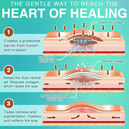 𝘾𝙖𝙧𝙚𝘽𝙧𝙚𝙚𝙯𝙚® Microneedle Scar Removal Patch