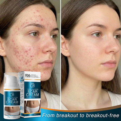 Avaleric® 100% Silicone Scar Cream Formula