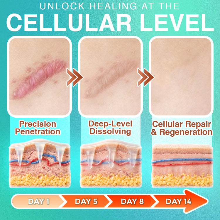 𝘾𝙖𝙧𝙚𝘽𝙧𝙚𝙚𝙯𝙚® Microneedle Scar Removal Patch