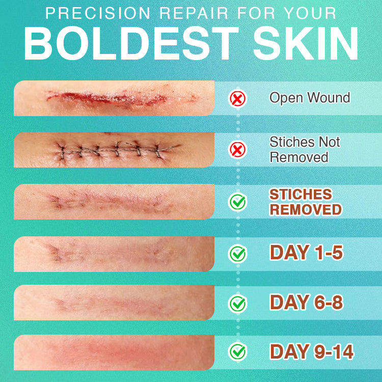 𝘾𝙖𝙧𝙚𝘽𝙧𝙚𝙚𝙯𝙚® Microneedle Scar Removal Patch
