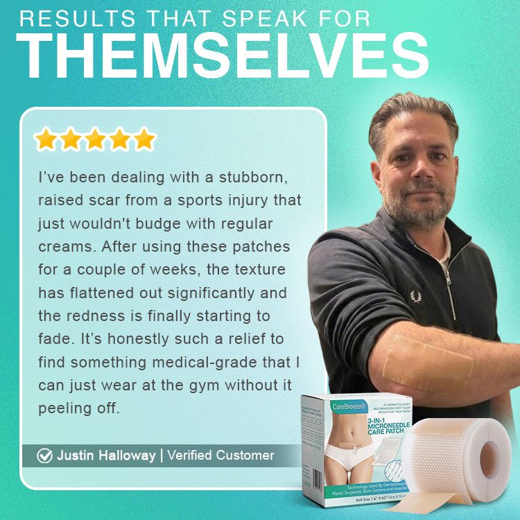 𝘾𝙖𝙧𝙚𝘽𝙧𝙚𝙚𝙯𝙚® Microneedle Scar Removal Patch