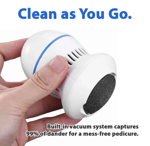 Avaleric® Vacuum Callus Remover✨