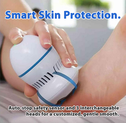 Avaleric® Vacuum Callus Remover✨