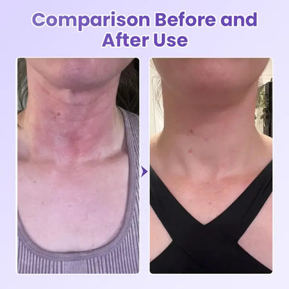 Avaleric® NeckYouth Peptide Anti-Wrinkle Patch