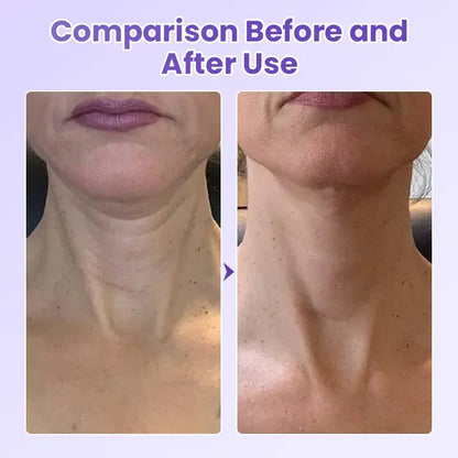 Avaleric® NeckYouth Peptide Anti-Wrinkle Patch