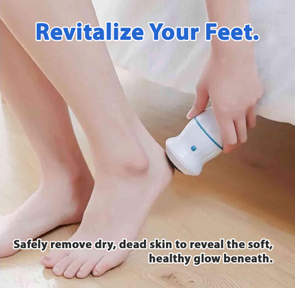 Avaleric® Vacuum Callus Remover✨