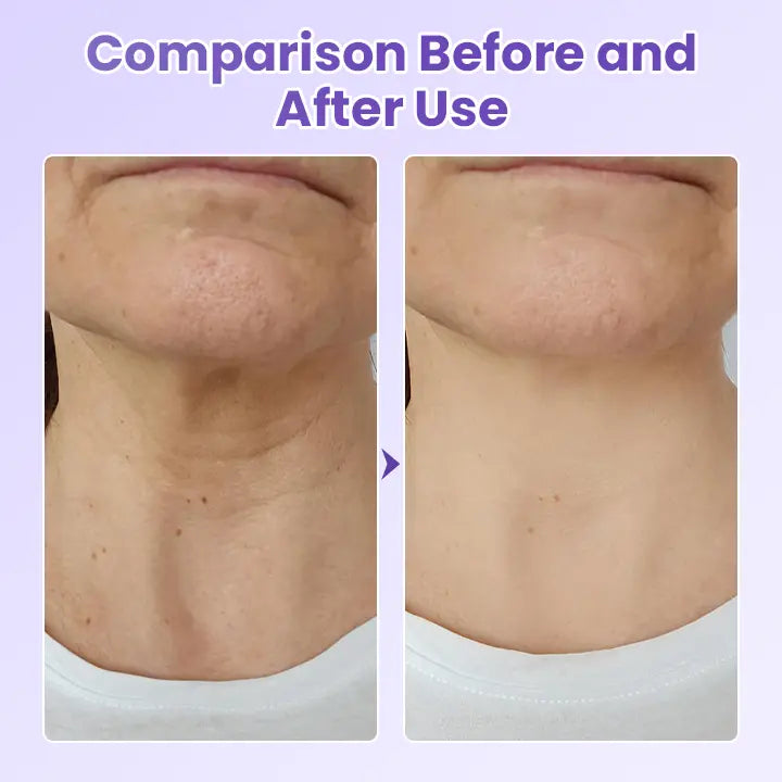 Avaleric® NeckYouth Peptide Anti-Wrinkle Patch